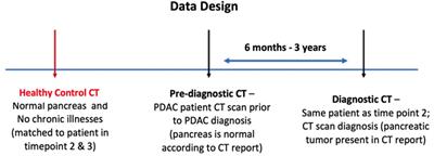 Risk prediction of pancreatic cancer using AI analysis of pancreatic subregions in computed tomography images